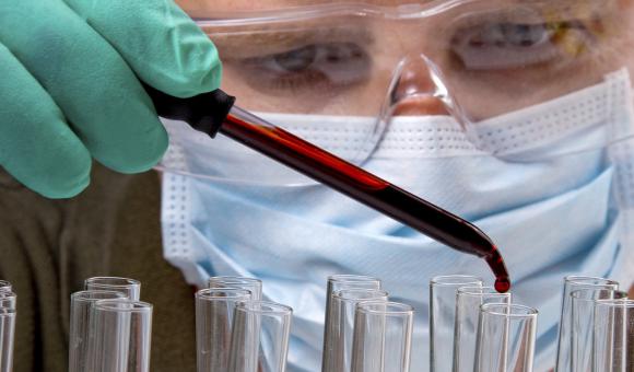 Collaboration entre Imcyse et Pfizer
