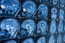 Les recherches d'Emmanuelle Wilhelm se concentrent sur le cerveau ©UCL Les recherches d'Emmanuelle Wilhelm se concentrent sur le cerveau ©UCL